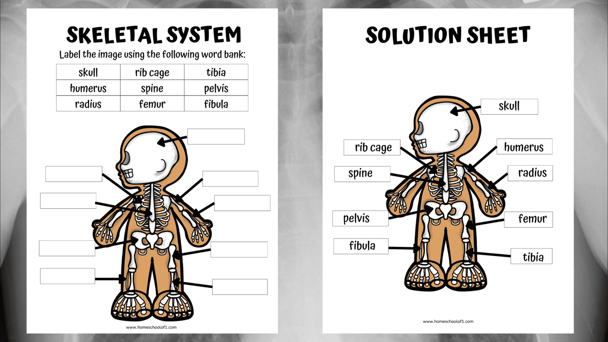 case study skeletal system worksheet