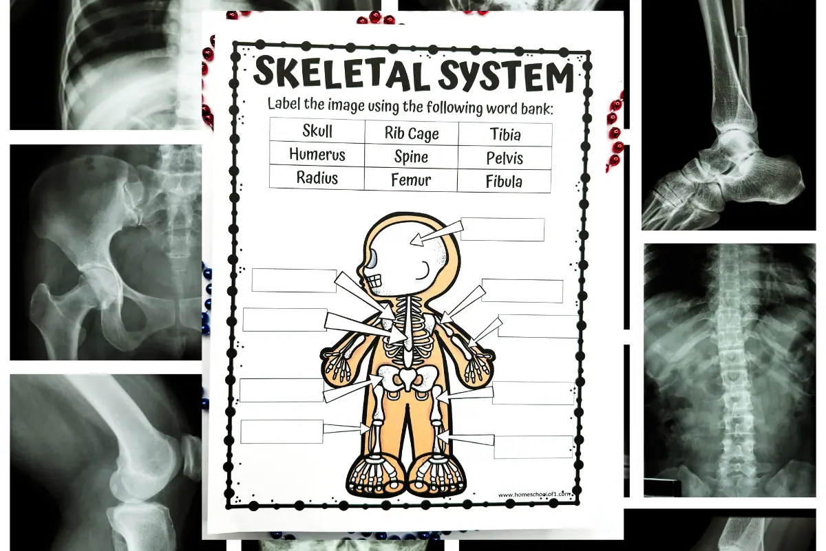 A skeletal system labeling worksheet with cartoon imagery, flanked by real x-ray images of various bones, merging anatomical education with actual bone imagery